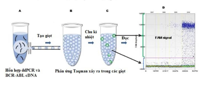 Ứng dụng PCR kỹ thuật số trong theo dõi điều trị bệnh bạch cầu mạn dòng tủy