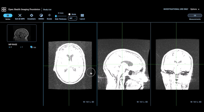 Tiến sĩ tạo phần mềm AI chẩn đoán bệnh Alzheimer trong 10 phút