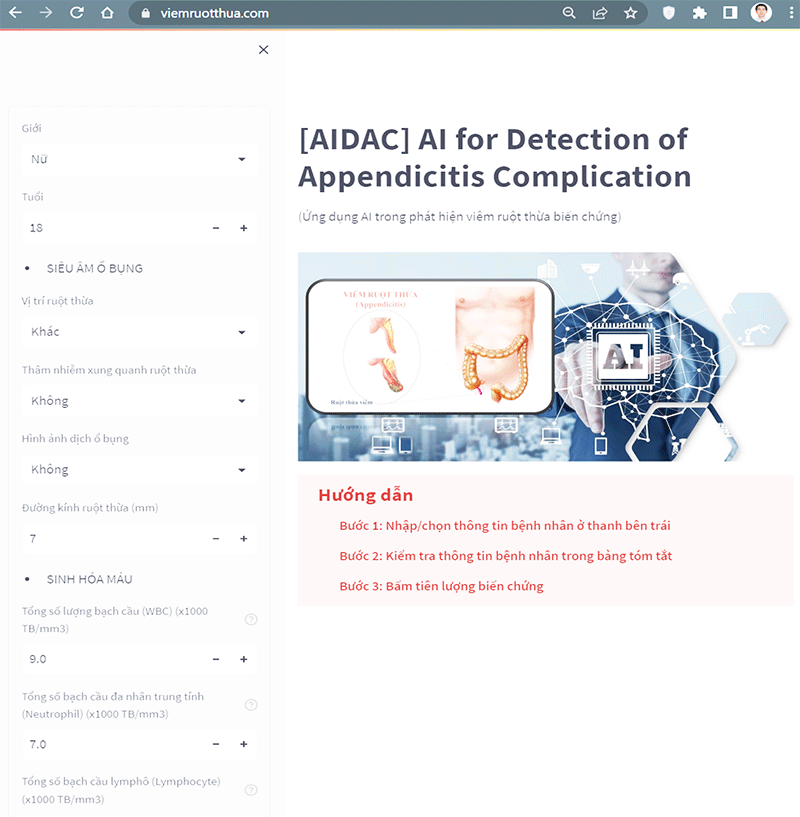 Mô hình chẩn đoán viêm ruột thừa có biến chứng
