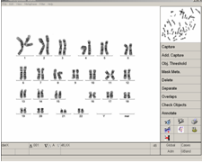 Karyotyping system: Hệ thống lập sơ đồ xét nghiệm nhiễm sắc thể